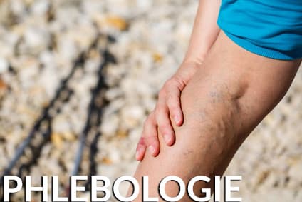 Phlebologie - Dr. Hilton & Partner