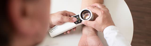 Dieses Bild zeigt den Untersuchungsprozess bei der Hautkrebsvorsorge.