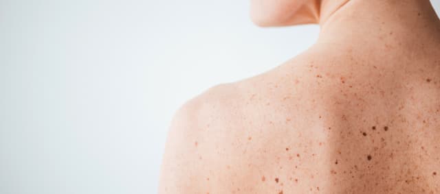 Dermatologie Dr. Charlotte Lambrecht