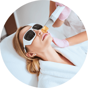 Frau mit Schutzbrille entspannt auf einer Liege in einer Hautarztpraxis für Dermatologie & Ästhetik während einer Laserbehandlung im Gesicht – Fokus auf ästhetisch-medizinische Behandlung in einer Hautarztpraxis für Dermatologie & Ästhetik in Leipzig.