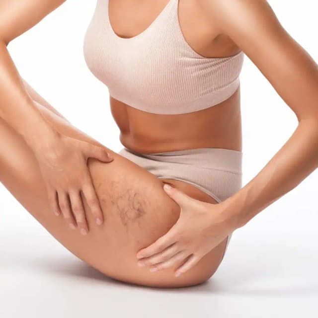 Phlebologie Venen Sendlinger Tor