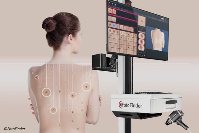 ATBM (Hautkrebsvorsorge unter Zuhilfenahme künstlicher Intelligenz)