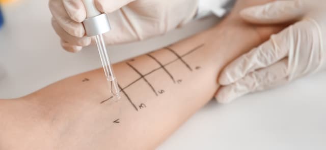 Allgemeine Dermatologie