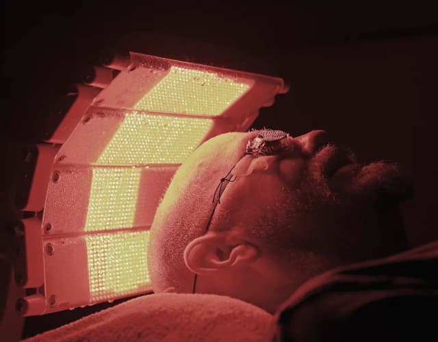 Photodynamische Therapie im Hautzentrum Obere Wässere