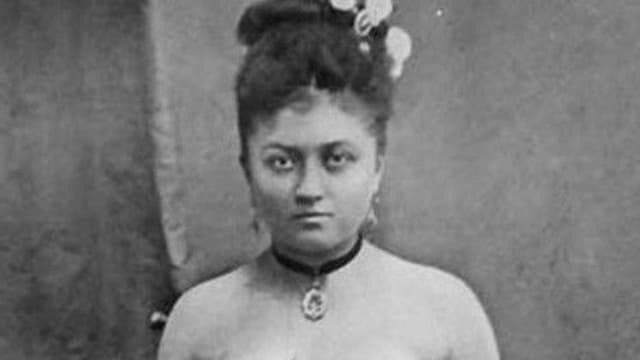 Příběh Blanche Dumas: jak se asi žilo ženě se třemi nohama a dvěma vaginami?