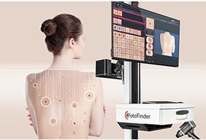 Vyšetření znamének