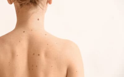 Hautscreening PLUS für die ganze Familie