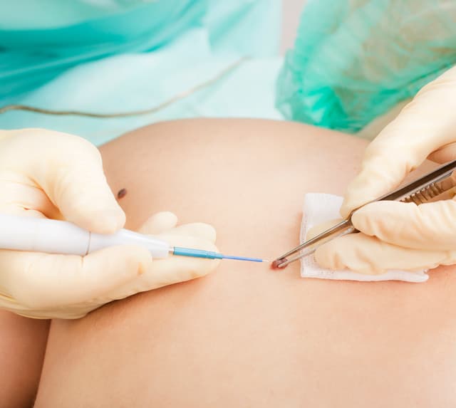 OPERATIVE DERMATOLOGIE