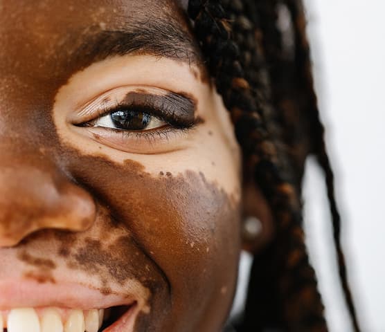 KONSERVATIVE DERMATOLOGIE