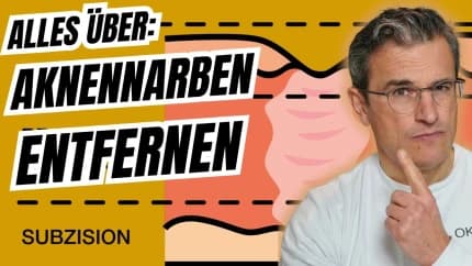 Aknenarben endlich verbessern: Kombitherapie erklärt  Dr. med. Robert Kasten