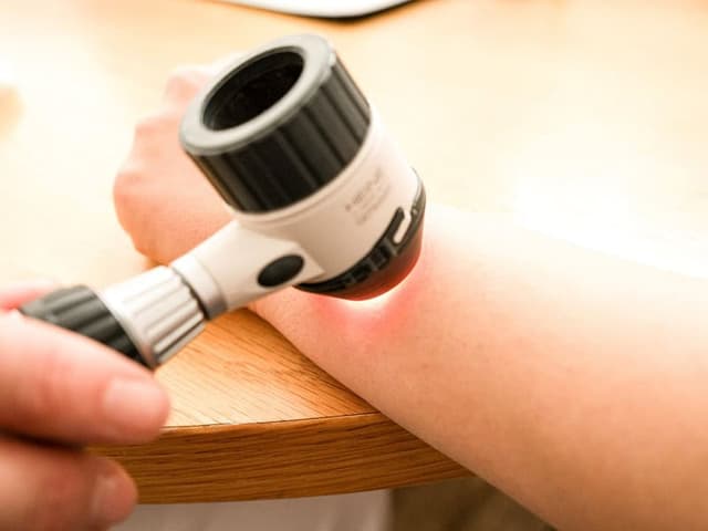 Hautkrebsscreening Prävention und Nachsorge