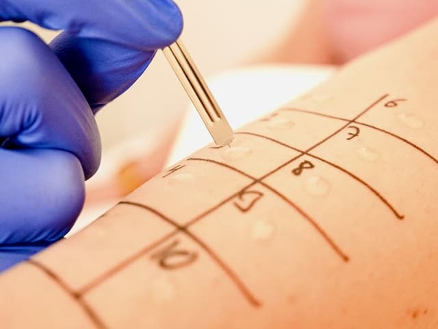 Klassische Dermatologie