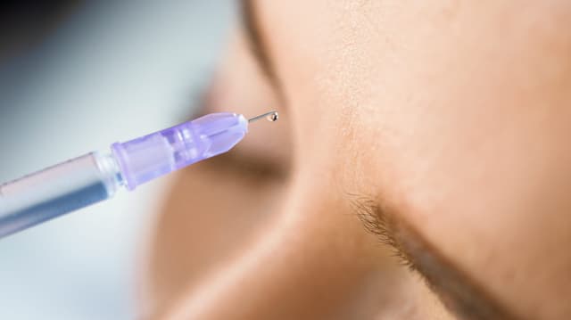 Nahaufnahme einer Narbenbehandlung mit Cortisonunterspritzung.