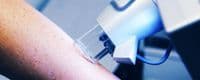 Lasertherapie an der Haut