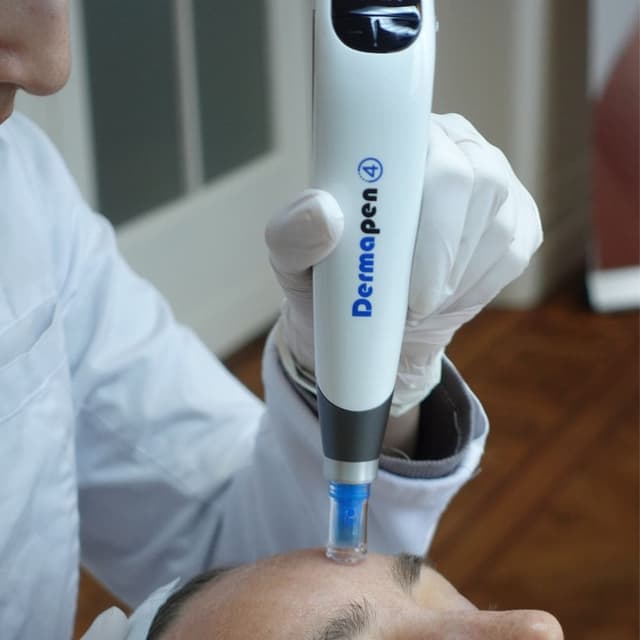 Microneedling (Dermapen)