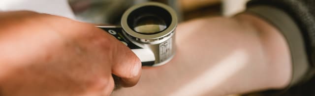 Hautuntersuchung mit Lupe am Unterarm.