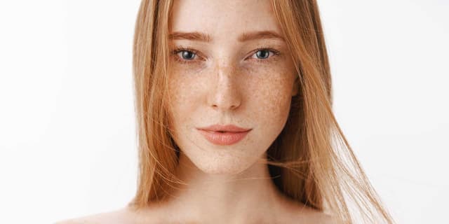 skinplan, dermatologie, botox, fillers, natuurlijk mooi