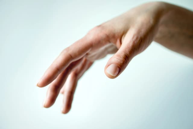 Dermatologie am Savignyplatz - Dr. med. Ev-Charlott Walter - Aktinische Kernlosen -