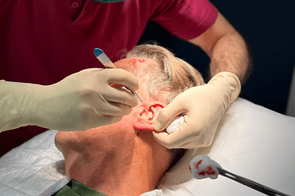 operative dermatologie 2.heic