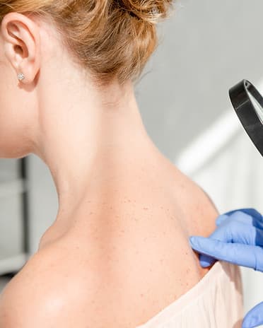 cropped-view-of-dermatologist-examining-skin-of-pa-2021-08-31-02-07-59-utc.jpg