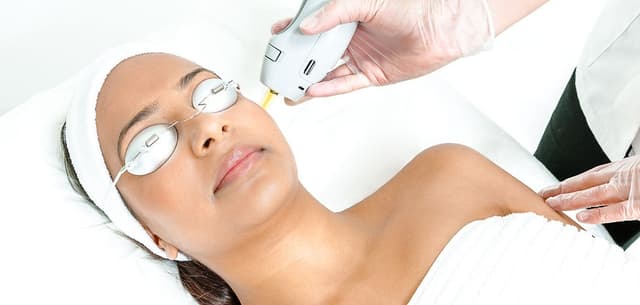 épilation laser montpellier