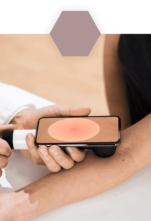 dr-kathrin-uhlig-derma-riedberg-startseite-leistungen-hautkrebs-vorsorge-ohne