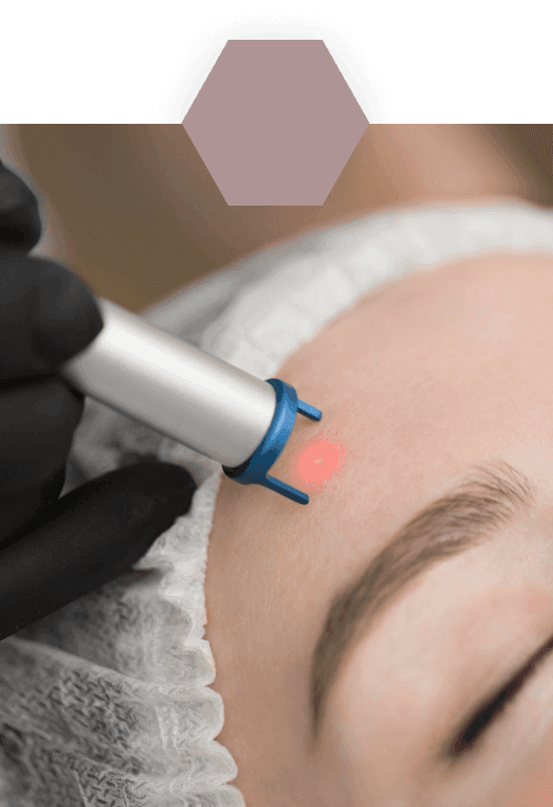 dr-kathrin-uhlig-derma-riedberg-startseite-leistungen-lasermedizin-ohne