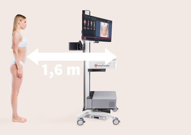 Ankündigung neues Verfahren für Muttermalkontrolle