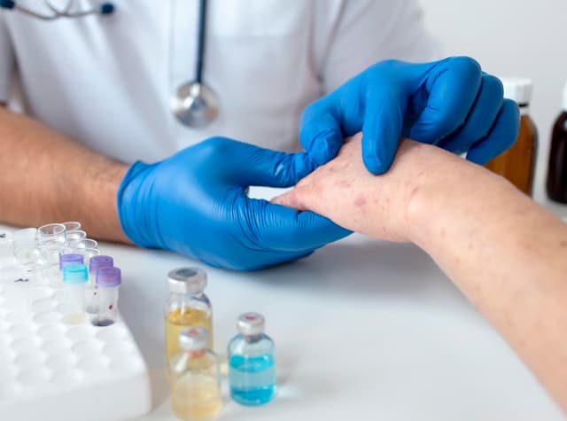 Allergietest Graz, Pricktest, Epikutantestt, Dermatologe Graz, Dr. Lichem