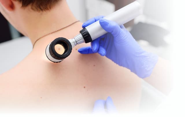 Ihre Praxis für Hautkrebsvorsorge in Schwerin