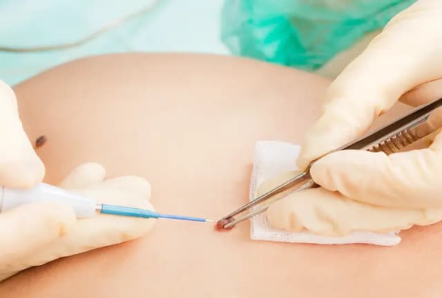 Detailaufnahme in der Hautarzt Privatpraxis Streikiene in Nürnberg