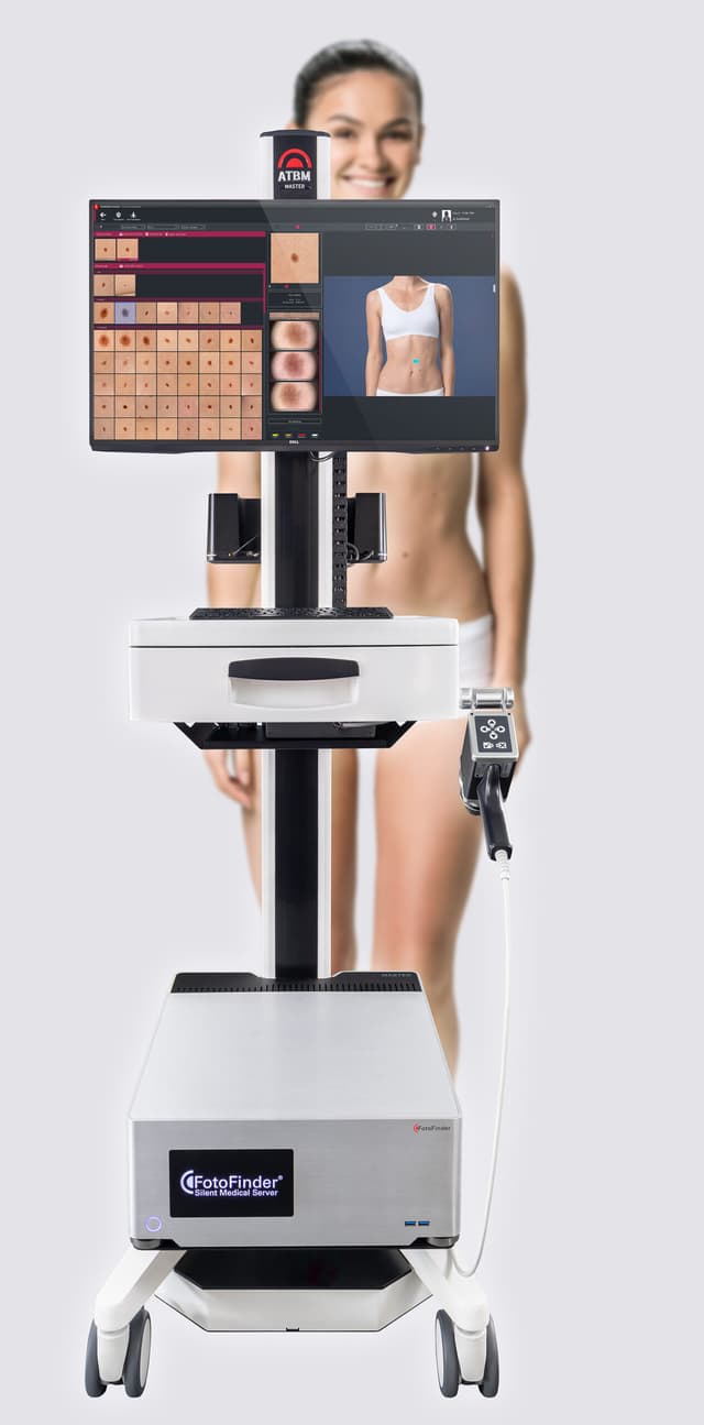 Medizinisches Gerät mit Monitor, der eine Software zur Hautanalyse anzeigt, davor steht eine Frau in Unterwäsche.